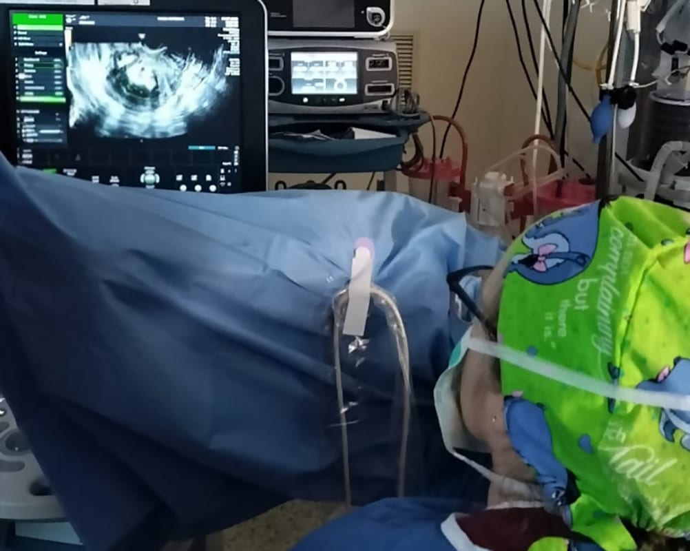 שרירנים ברחם. טיפול חדש בגלי רדיו